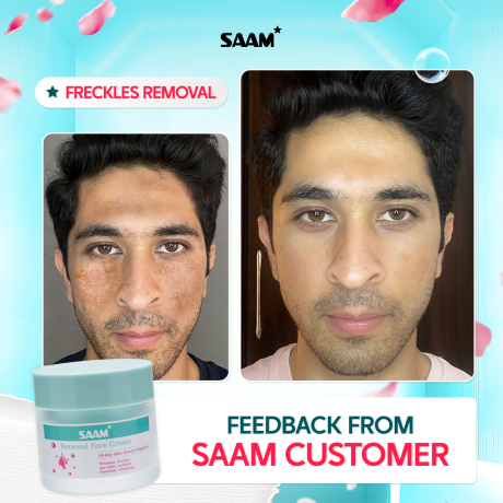 SAAM Renewal Face Cream 50g for Melasma and Freckles Treatment